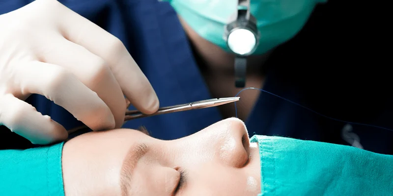 Top 5 Rhinoplasty Clinics in Ho Chi Minh 4 Rhinoplasty Clinics in Ho Chi Minh