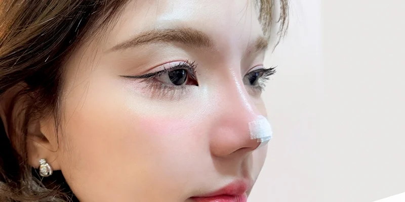 Top 5 Rhinoplasty Clinics in Ho Chi Minh 1 Rhinoplasty Clinics in Ho Chi Minh